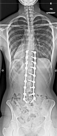 SK Spine | Orthodontics, Sports Mouthguards and Implant Restorations