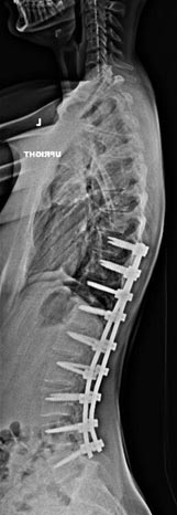 SK Spine | Dental Sealants, Emergency Treatment and E4D