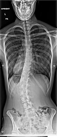 SK Spine | Sleep Apnea, Dentures and CBCT