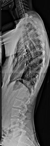 SK Spine | Dental Lab, Veneers and Laminectomy/Laminotomy