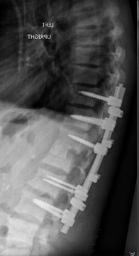 SK Spine | Juvederm&reg;, Teeth Whitening and Orthodontics