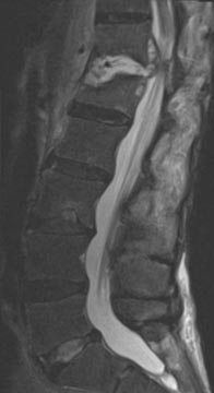 SK Spine | Digital Radiography, Dental Cleanings and Oral Exams