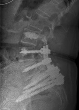 SK Spine | Implant Restorations, CEREC and Dental Lab