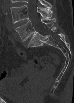 SK Spine | LANAP&reg;, Digital Radiography and Sports Mouthguards