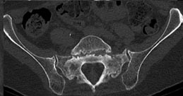 SK Spine | Root Canals, Air Abrasion and CEREC