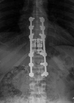 SK Spine | Invisalign&reg;, VELscope&reg; Cancer Screening and ClearCorrect&reg;