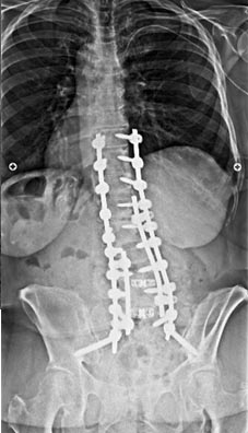 SK Spine | ClearCorrect&reg;, TMJ Disorders and Snoring Appliances