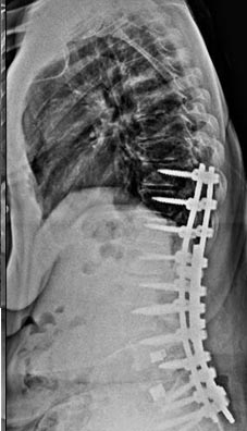 SK Spine | Implant Dentistry, Invisalign&reg; and Sleep Apnea