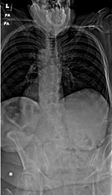 SK Spine | Laser Dentistry, Digital Radiography and Night Guards