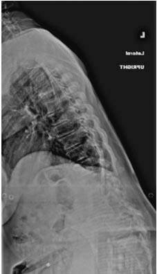 SK Spine | VELscope&reg; Cancer Screening, Juvederm&reg; and Oral Cancer Screening