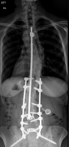 SK Spine | Preventative Program, Pediatric Dentistry and Oral Cancer Screening