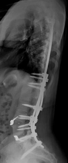 SK Spine | ClearCorrect&reg;, TMJ Disorders and Sports Mouthguards