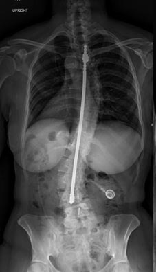 SK Spine | CEREC, CBCT and Emergency Treatment