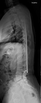 SK Spine | All-on-6&reg;, ClearCorrect&reg; and LANAP&reg;