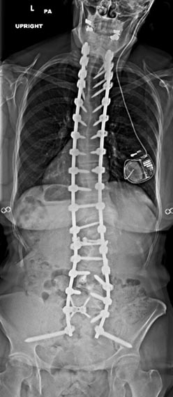 SK Spine | Snoring Appliances, CEREC and Digital Radiography