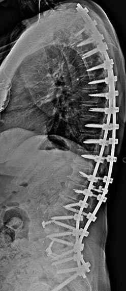 SK Spine | Dental Sealants, Emergency Treatment and Botox&reg;