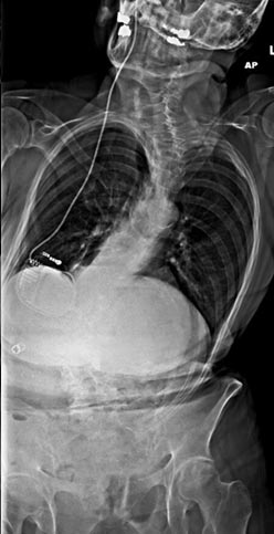 SK Spine | Sleep Apnea, Emergency Treatment and Periodontal Treatment