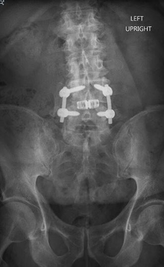 SK Spine | Dentures, Cosmetic Dentistry and Emergency Treatment