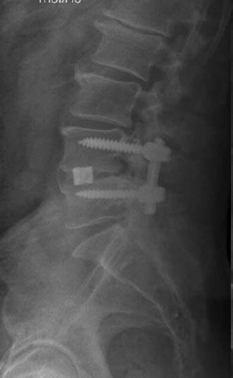 SK Spine | Juvederm&reg;, Inlays & Onlays and CEREC