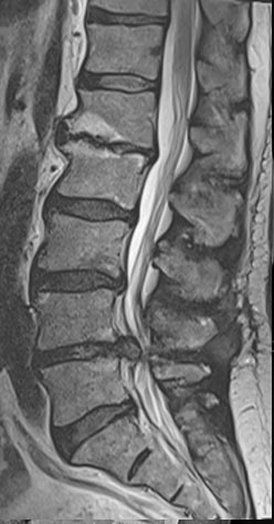 SK Spine | Laminectomy/Laminotomy, Dental Bridges and Implant Dentistry