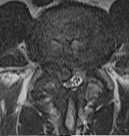 SK Spine | Fluoride Treatment, Botox&reg; and Pediatric Dentistry