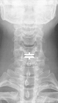 SK Spine | Botox reg , Veneers and Pediatric Dentistry
