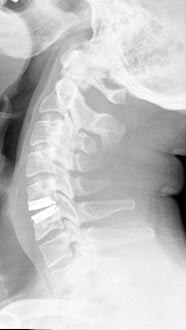 SK Spine | Intraoral Camera, Emergency Treatment and TMJ Disorders