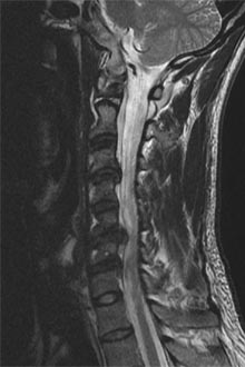 SK Spine | Emergency Treatment, Laminectomy Laminotomy and Implant Dentistry