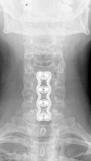 SK Spine | Digital Impressions, Dermal Fillers and Night Guards