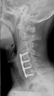 SK Spine | Pediatric Dentistry, Snoring Appliances and Laser Dentistry