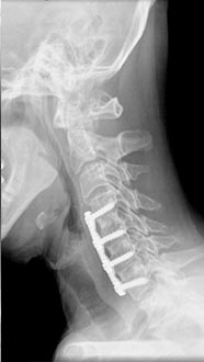 SK Spine | Dermal Fillers, Full Mouth Reconstruction and All-on-4 reg