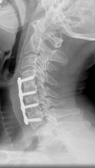 SK Spine | Dermal Fillers, Dental Fillings and Preventative Program