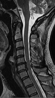 SK Spine | Implant Restorations, Crowns and Emergency Treatment