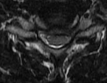 SK Spine | LANAP reg , Dental Bridges and Juvederm reg