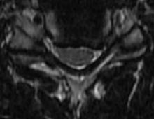 SK Spine | Air Abrasion, Cosmetic Dentistry and Full Mouth Reconstruction