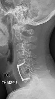 SK Spine | Emergency Treatment, Crowns and Dental Bridges