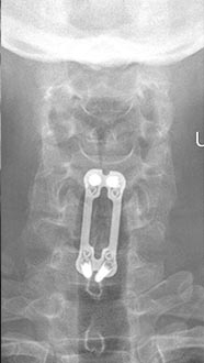 SK Spine | Emergency Treatment, Teeth Whitening and Dental Bridges