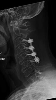 SK Spine | Implant Restorations, Dental Bridges and Juvederm reg