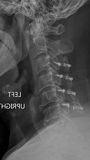 SK Spine | ClearCorrect&reg;, Preventative Program and Juvederm&reg;