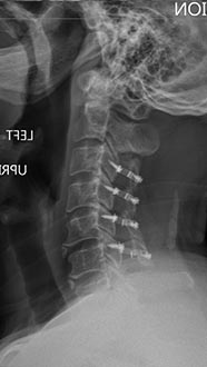 SK Spine | TMJ Disorders, Periodontal Treatment and VELscope&reg; Cancer Screening
