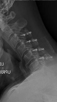 SK Spine | Dental Bridges, CEREC and Laminectomy/Laminotomy