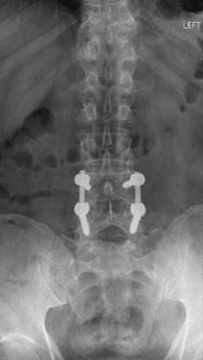 SK Spine | Emergency Treatment, Crowns and Teeth Whitening