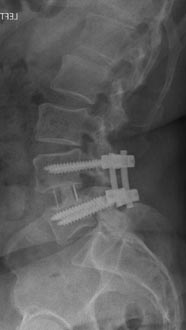 SK Spine | Veneers, Implant Dentistry and Botox&reg;