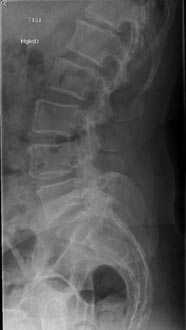 SK Spine | Dentures, Full Mouth Reconstruction and Preventative Program