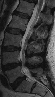 SK Spine | Fluoride Treatment, Laminectomy/Laminotomy and Pediatric Dentistry