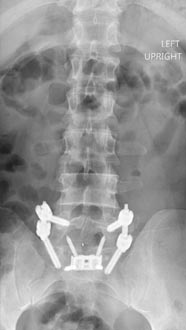 SK Spine | Dental Lab, Implant Restorations and Fluoride Treatment