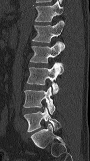 SK Spine | Laser Dentistry, Implant Restorations and Juvederm&reg;