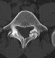 SK Spine | Pediatric Dentistry, Implant Restorations and Preventative Program