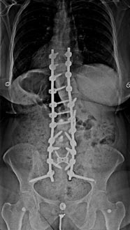 SK Spine | Dental Lab, Snoring Appliances and Oral Cancer Screening