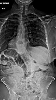SK Spine | Oral Exams, Extractions and Oral Cancer Screening